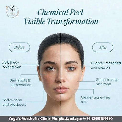 Chemical peel visible transformation before and after result