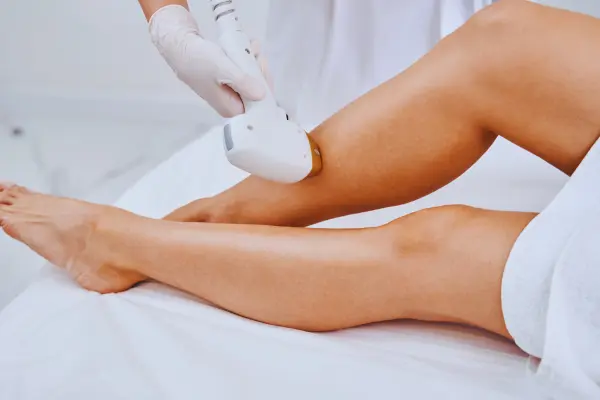 Clinician performing laser hair reduction treatment
