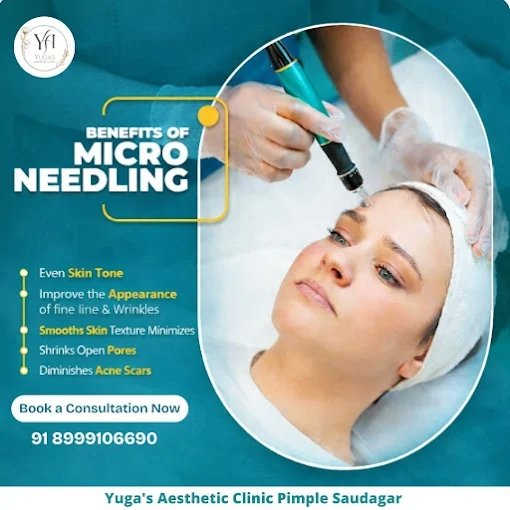 Benefits of microneedling treatment poster